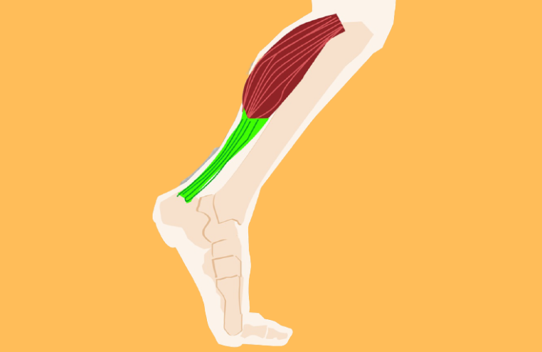 As EpA-ARE Juvenis são um grupo de doenças inflamatórias crónicas das articulações (artrite) e das ligações dos tendões e ligamentos a determinados os
