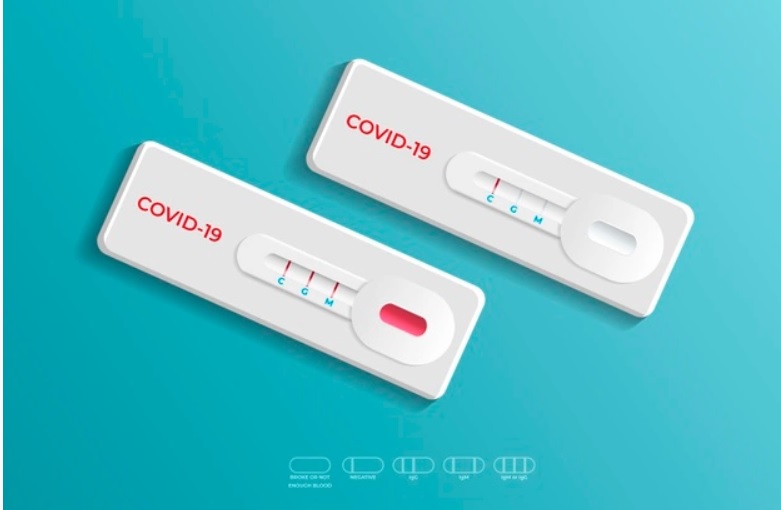 Os autotestes de COVID-19, serão disponibilizados em farmácias e órgãos de saúde para venda.