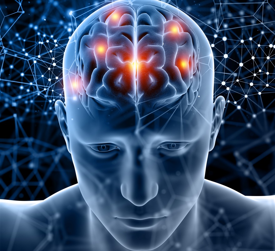 A esclerose múltipla é uma doença neurológica desmielinizante autoimune crônica provocada por mecanismos inflamatórios e degenerativos que comprometem