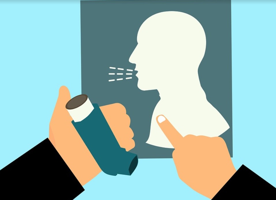 A asma (também conhecida como “bronquite asmática” ou como “bronquite alérgica”) é uma doença que acomete os pulmões, acompanhada de uma inflamação cr