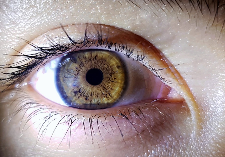 A retinopatia diabética é uma lesão da retina (estrutura transparente e sensível à luz, localizada na parte posterior do olho) que tem como causa o di