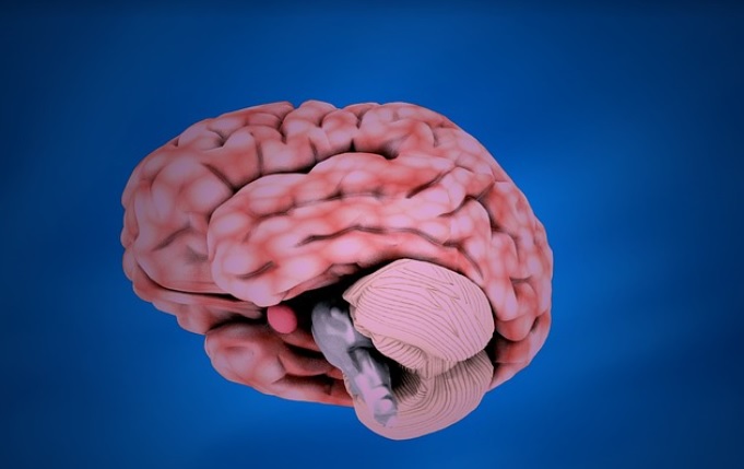 A Adrenoleucodistrofia (ALD) é uma patologia ligada ao X caracterizada por desmielinização progressiva do sistema nervoso central 